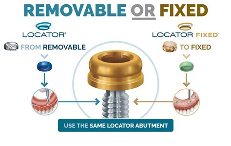 locator implants for sale